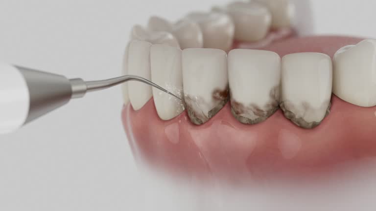 Trusted Teeth Whitening service in Anson, TX - Dentist Open Now